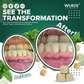WUEIS® - Remineralizing Gum Teeth Whitening
