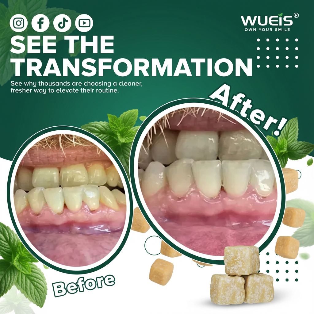 WUEIS® - Remineralizing Gum Teeth Whitening
